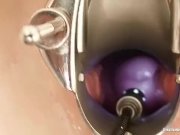 Skinny teen kinky gyno exam and anal plug 16/16