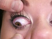 Iveta gyno pussy and anal speculum checkup  4/16