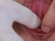Busty Jenny extreme pussy gaping on gyno chai 9/16