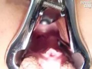 Rachael gyno speculum explicit kinky gyno 9/16