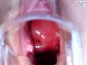 Terri gyno visit  12/16