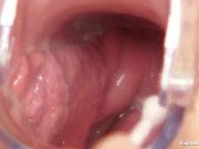 Blonde Bella Morgan visit gynoclinic 10/16