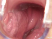 Blonde Bella Morgan visit gynoclinic 9/16