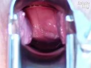 Shandi getting her pussy check  15/16