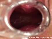 Puffy peach teen plays with speculum 9/16