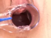 Britney s Pussy Stretched Wide by Speculum 6/16