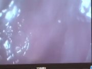 Amateur, Ria Sakurai, blows while having anot 7/16