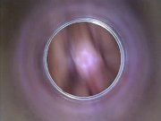 Kira - Kinky selfie (endoscope pussy cam) 5/16