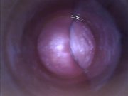 Kira - Kinky selfie (endoscope pussy cam) 9/16