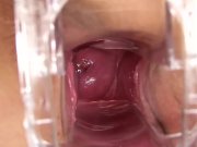 PJGIRLS Macro pussy - Exploration deep inside Nathaly's pussy with speculum 15/16