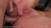 Anal